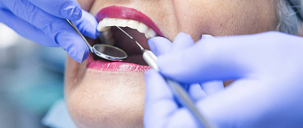 Best Walk-In Emergency Dentist in Elida, OH